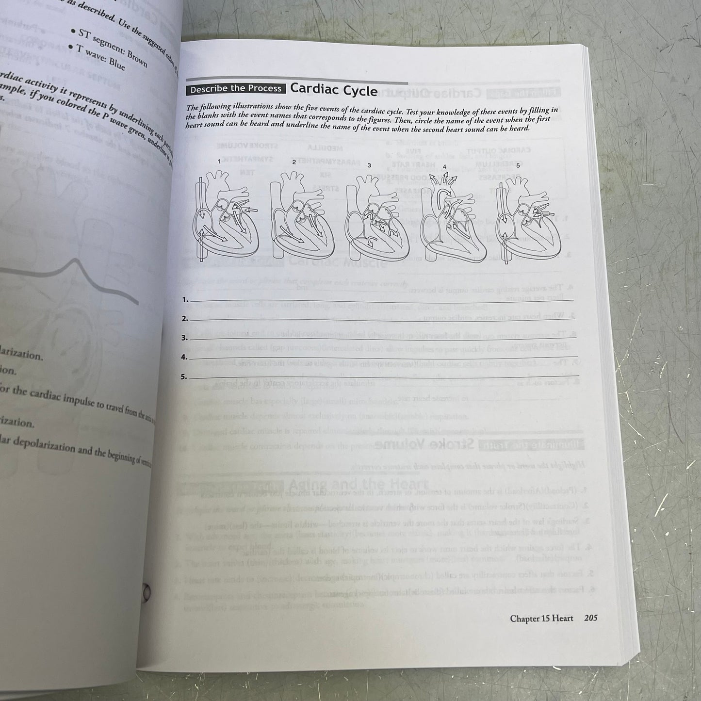 STUDY GUIDE FOR UNDERSTANDING ANATOMY & PHYSIUOLOGY 4TH ED Paperback Book