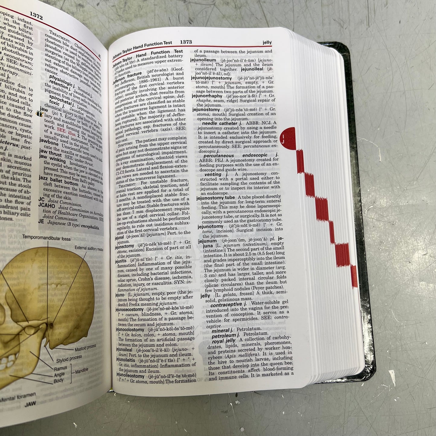 EDITION 25 TABER'S CYCLOPEDIC MEDICAL DICTIONARY Paperback Book By Donald Venes